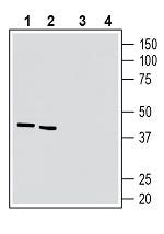 5HT7 Receptor/HTR7 (extracellular) Blocking Peptide