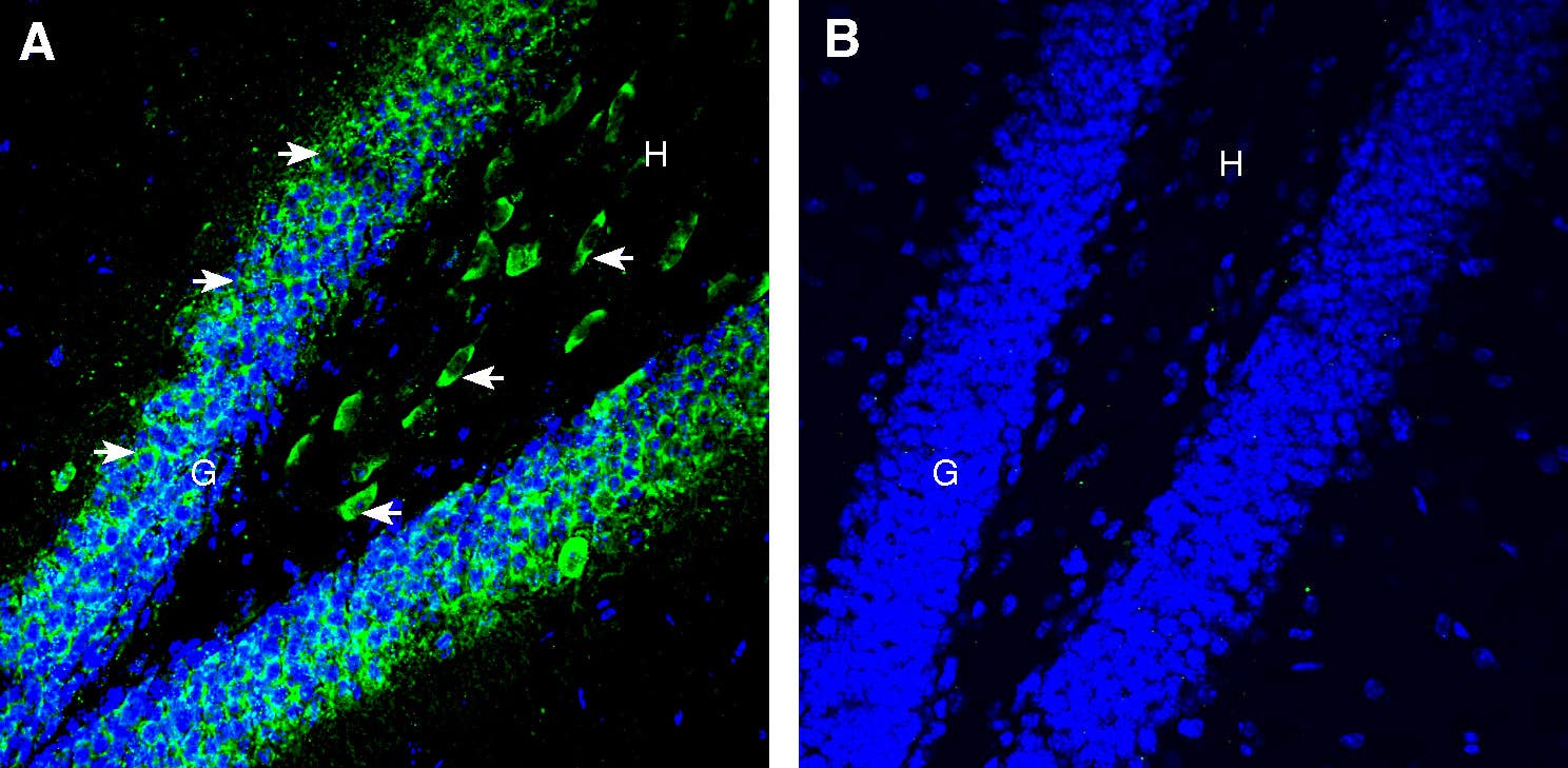Anti-5HT6 Receptor (HTR6) (extracellular) Antibody