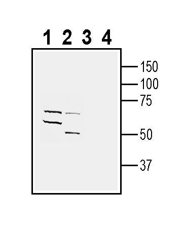 5HT6 Receptor (HTR6) (extracellular) Blocking Peptide