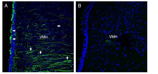 Anti-Semaphorin 4A (SEMA4A) (extracellular) Antibody