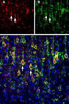 Anti-Slitrk1 (extracellular) Antibody