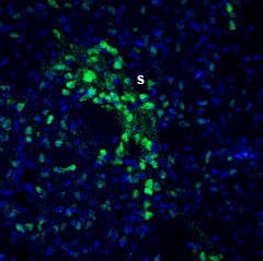 Anti-Slitrk2 (extracellular) Antibody