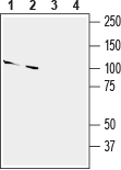 Slitrk2 (extracellular) Blocking Peptide
