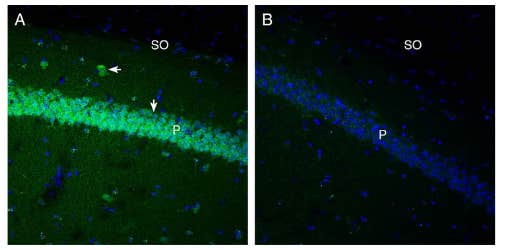 Anti-GPR91 (SUCNR1) (extracellular) Antibody