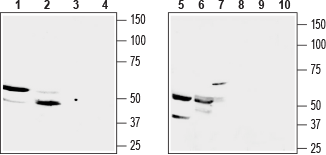 GPR91/SUCNR1 (extracellular) Blocking Peptide