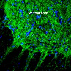 Anti-SLC17A5 (Sialin) Antibody