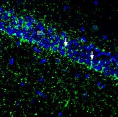 Anti-SVCT2/SLC23A2 (extracellular) Antibody