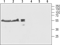 Anti-TRIC-B (TMEM38B) Antibody - Carrier Free
