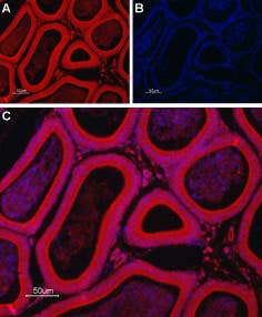 Anti-TRIC-B (TMEM38B) Antibody