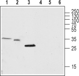 TRIC-A/TMEM38A Blocking Peptide