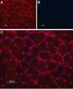 Anti-TRIC-A (TMEM38A) Antibody
