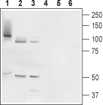 TMC6/EVER1 Blocking Peptide