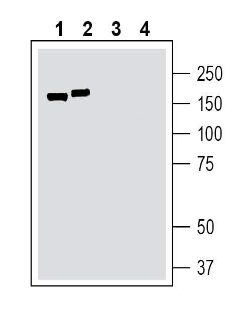 TMC1 (extracellular) Blocking Peptide