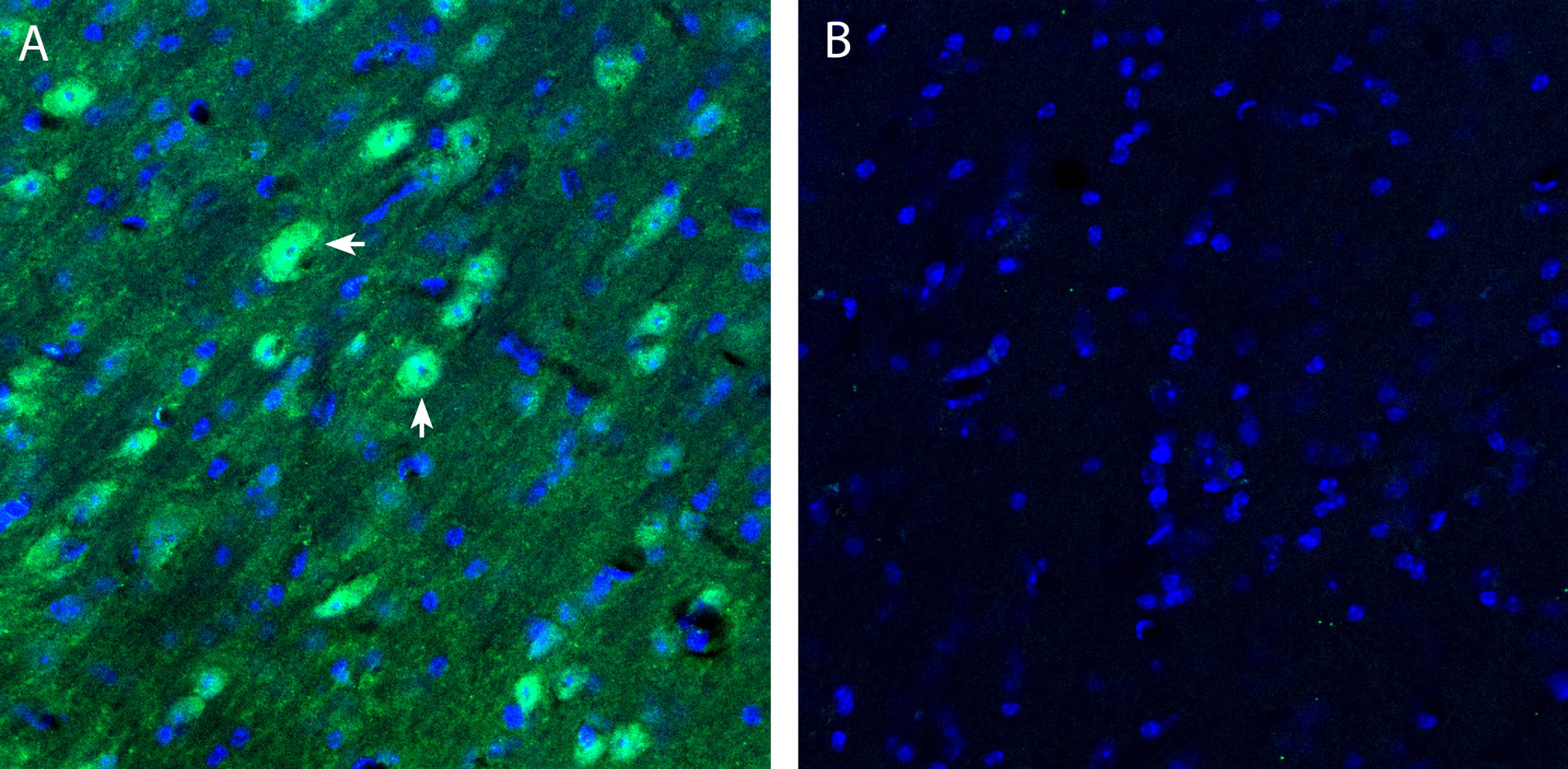 Anti-Neurokinin 2 Receptor (NK2R) Antibody