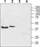 Neurokinin 2 Receptor/NK2R Blocking Peptide