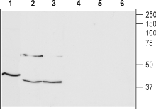 Anti-TRHR1 Antibody