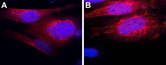Anti-TRHR1 Antibody