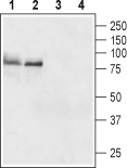 TSH Receptor/TSHR (extracellular) Blocking Peptide