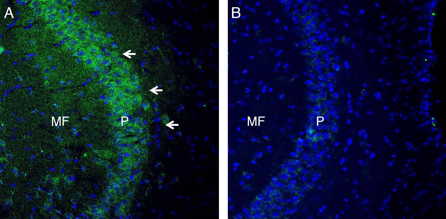 Anti-TSH Receptor (TSHR) (extracellular) Antibody