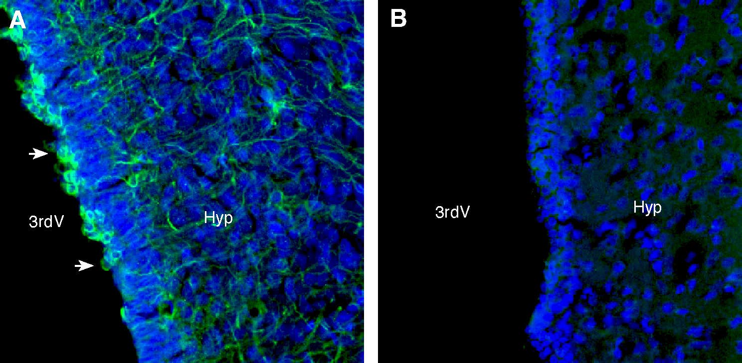 Anti-Taste Receptor Type 1 Member 3 (TAS1R3) (extracellular) Antibody