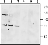 VPAC1/VIPR1 (extracellular) Blocking Peptide