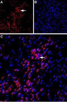 Anti-VPAC1 (VIPR1) (extracellular) Antibody