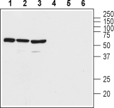 Anti-VPAC2 (VIPR2) (extracellular) Antibody