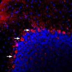 Anti-PACAP Receptor 1 (PAC1) Antibody