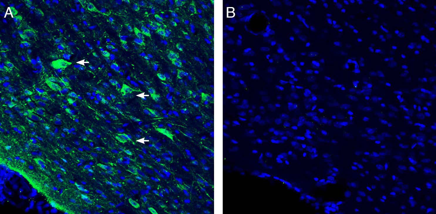 Anti-Vasopressin V<sub>1A</sub> Receptor (AVPR1A) Antibody