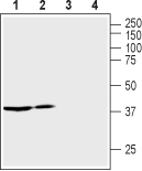 Anti-Vasopressin V<sub>2</sub> Receptor (AVPR2) Antibody