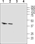 ZIP1/SLC39A1 (extracellular) Blocking Peptide