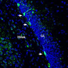 Anti-ZIP8 (SLC39A8) (extracellular) Antibody