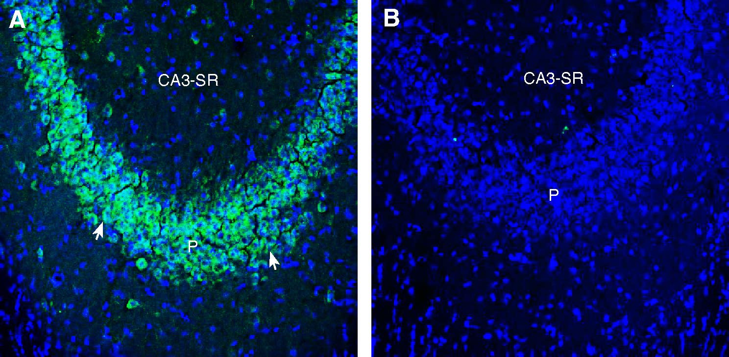 Anti-ZIP10/SLC39A10 (extracellular) Antibody