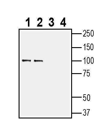 ZIP10/SLC39A10 (extracellular) Blocking Peptide