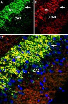 Anti-ZnT3 (SLC30A3) Antibody