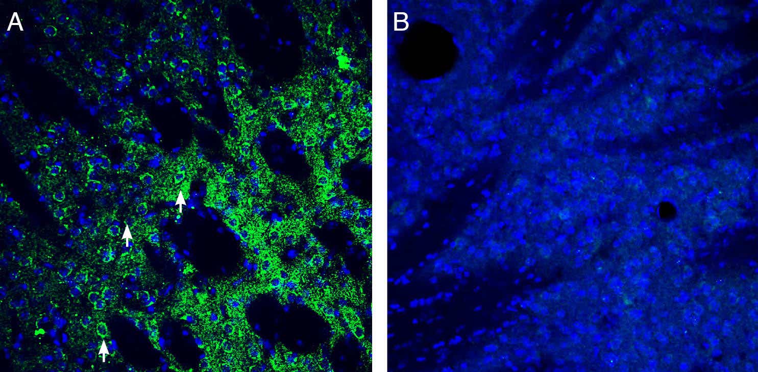 Anti-ZIP14 (SLC39A14) Antibody