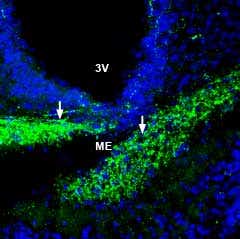 Anti-ZIP6/SLC39A6 (extracellular) Antibody