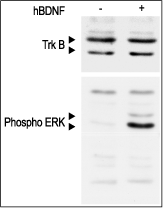 Recombinant human BDNF protein