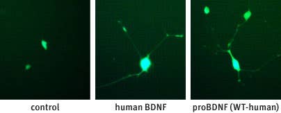 Recombinant human proBDNF protein