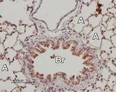 Anti-Adenosine A<sub>2B</sub> Receptor (extracellular) Antibody