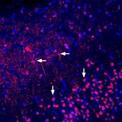 Anti-Adenosine A<sub>2A</sub> Receptor (extracellular) Antibody