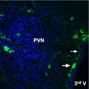 Anti-Angiotensin II Receptor Type-2 (extracellular)-ATTO Fluor-488 Antibody