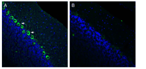 Anti-Renin Receptor/ATP6AP2 (extracellular) Antibody