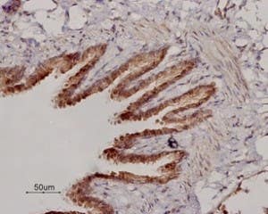 Anti-β<sub>2</sub>-Adrenergic Receptor (extracellular) Antibody