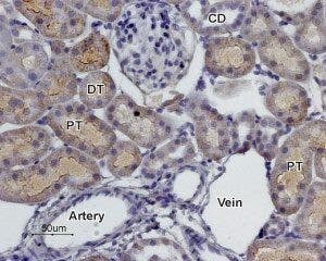 Anti-α<sub>2C</sub>-Adrenergic Receptor (extracellular) Antibody