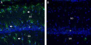Anti-C5aR2 (extracellular) Antibody