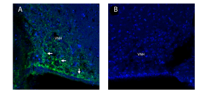 Adiponectin Receptor 1 Blocking Peptide