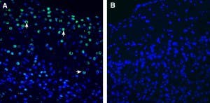 Anti-Neuronal Pentraxin 2 (NPTX2) Antibody