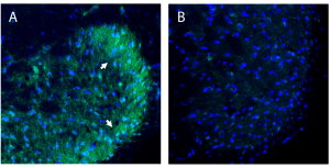 Anti-B1 Bradykinin Receptor (BDKRB1) (extracellular) Antibody
