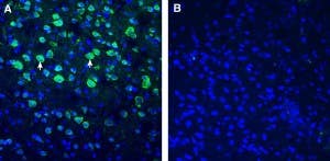 Anti-BMPR1A (extracellular) Antibody